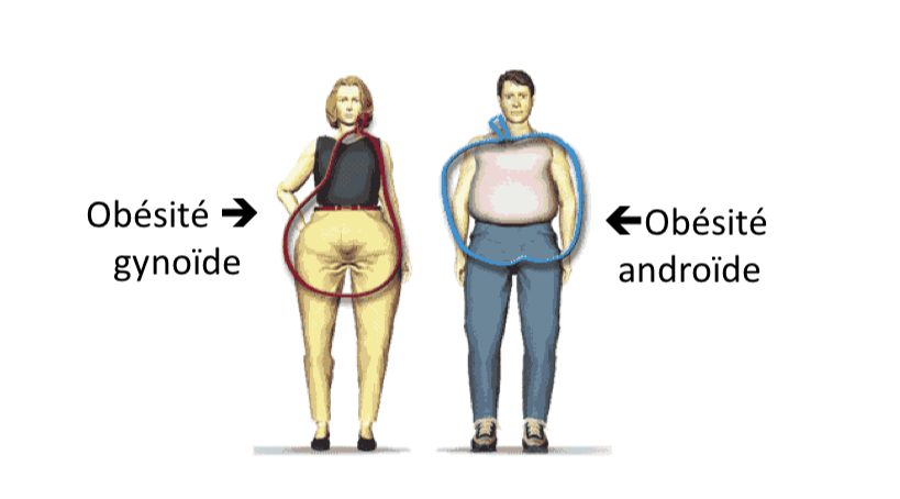 Distinction entre obesite androide et gynoide selon Jean Vague
